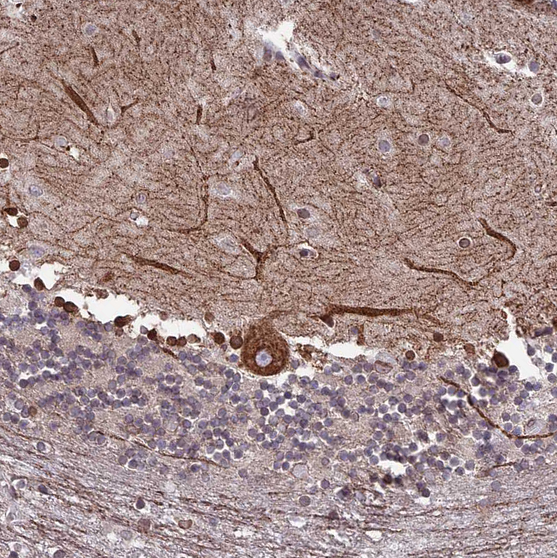 Immunohistochemistry (Formalin/PFA-fixed paraffin-embedded sections) - Anti-C6orf138 antibody (AB122705), expandable thumbnail