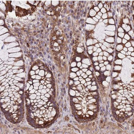 Immunohistochemistry (Formalin/PFA-fixed paraffin-embedded sections) - Anti-C6orf203 antibody (AB151066)
