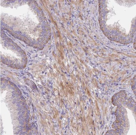 Immunohistochemistry (Formalin/PFA-fixed paraffin-embedded sections) - Anti-C6orf203 antibody (AB151066)