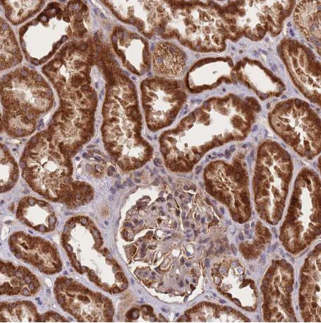 Immunohistochemistry (Formalin/PFA-fixed paraffin-embedded sections) - Anti-C6orf203 antibody (AB151066)