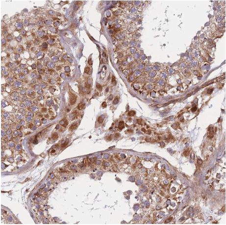 Immunohistochemistry (Formalin/PFA-fixed paraffin-embedded sections) - Anti-C6orf203 antibody (AB151066)