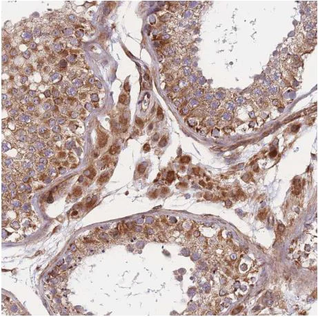 Immunohistochemistry (Formalin/PFA-fixed paraffin-embedded sections) - Anti-C6orf203 antibody (AB151066)