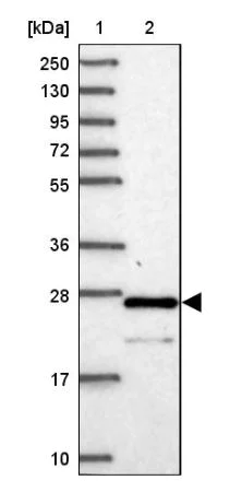 Western blot - Anti-C6orf203 antibody (AB151066)