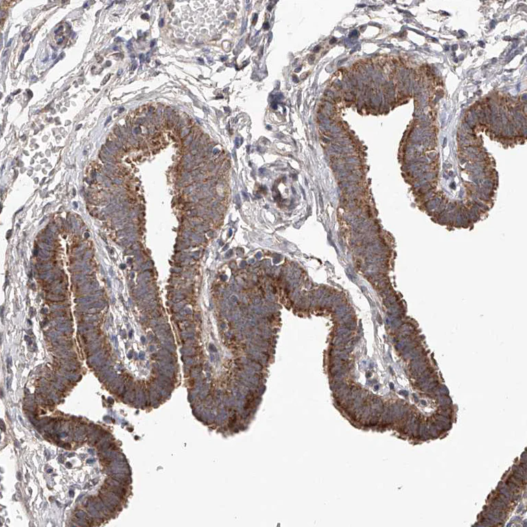 Immunohistochemistry (Formalin/PFA-fixed paraffin-embedded sections) - Anti-C6orf57 antibody (AB122196)
