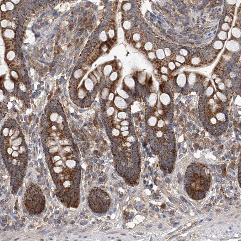 Immunohistochemistry (Formalin/PFA-fixed paraffin-embedded sections) - Anti-C6orf57 antibody (AB122196)