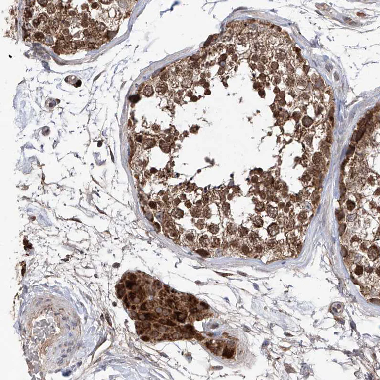 Immunohistochemistry (Formalin/PFA-fixed paraffin-embedded sections) - Anti-C6orf57 antibody (AB122196)