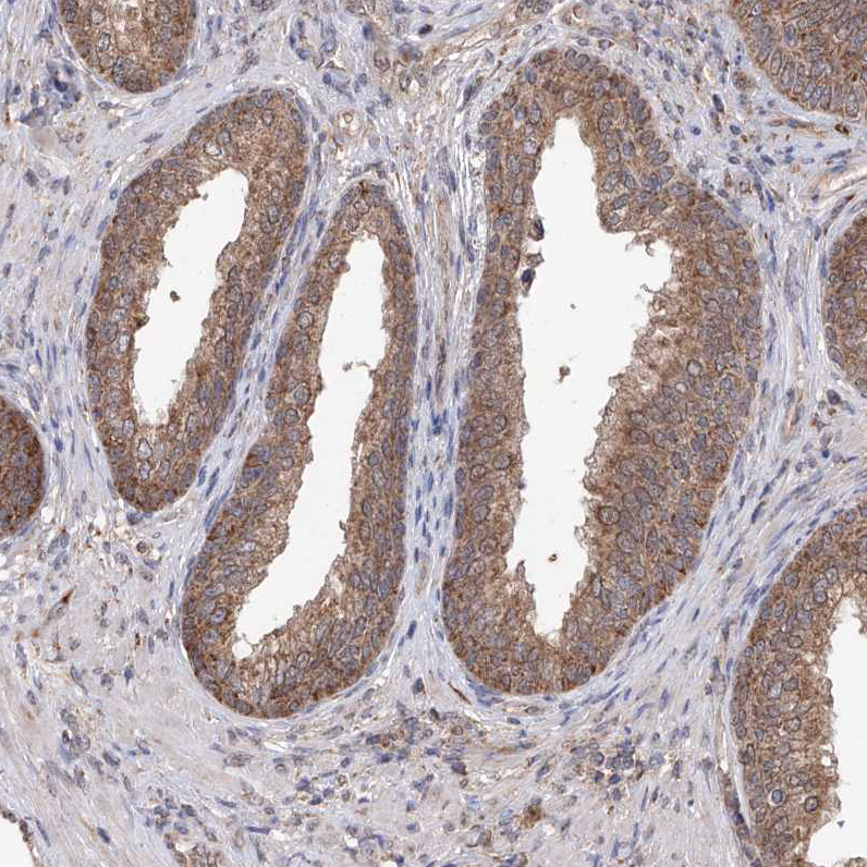 Immunohistochemistry (Formalin/PFA-fixed paraffin-embedded sections) - Anti-C6orf57 antibody (AB122196), expandable thumbnail
