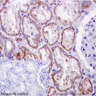 Immunohistochemistry (Formalin/PFA-fixed paraffin-embedded sections) - Anti-C6orf64 antibody [EPR15780] - C-terminal (AB189918), expandable thumbnail