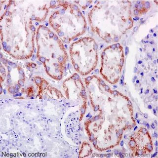 Immunohistochemistry (Formalin/PFA-fixed paraffin-embedded sections) - Anti-C6orf64 antibody [EPR15780] - C-terminal (AB189918)