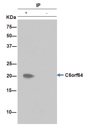 Immunoprecipitation - Anti-C6orf64 antibody [EPR15780] - C-terminal (AB189918), expandable thumbnail