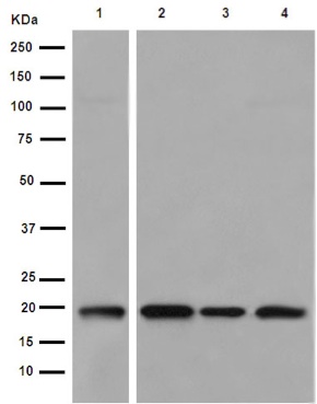 Western blot - Anti-C6orf64 antibody [EPR15780] - C-terminal (AB189918), expandable thumbnail