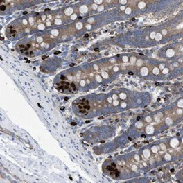 Immunohistochemistry (Formalin/PFA-fixed paraffin-embedded sections) - Anti-C7orf51 antibody (AB121711)