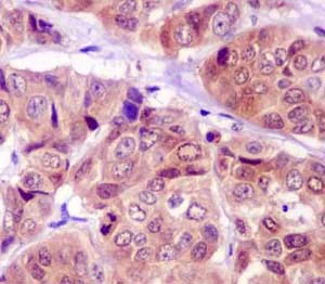 Immunohistochemistry (Formalin/PFA-fixed paraffin-embedded sections) - Anti-C8orf30A antibody [EPR13203-28] - BSA and Azide free (AB250296)