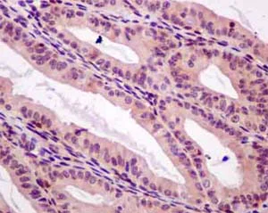 Immunohistochemistry (Formalin/PFA-fixed paraffin-embedded sections) - Anti-C8orf30A antibody [EPR13203-28] - BSA and Azide free (AB250296)