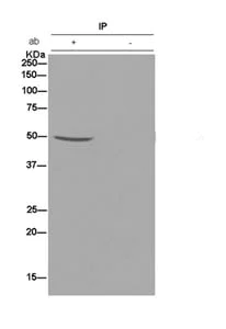 Immunoprecipitation - Anti-C8orf30A antibody [EPR13203-28] - BSA and Azide free (AB250296)