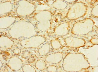 Immunohistochemistry (Formalin/PFA-fixed paraffin-embedded sections) - Anti-C8ORF34 antibody (AB235086)