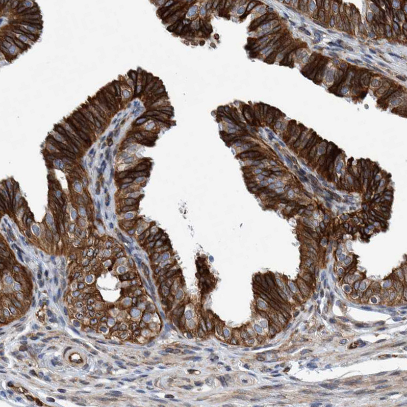 Immunohistochemistry (Formalin/PFA-fixed paraffin-embedded sections) - Anti-C8orf55 antibody (AB121743), expandable thumbnail