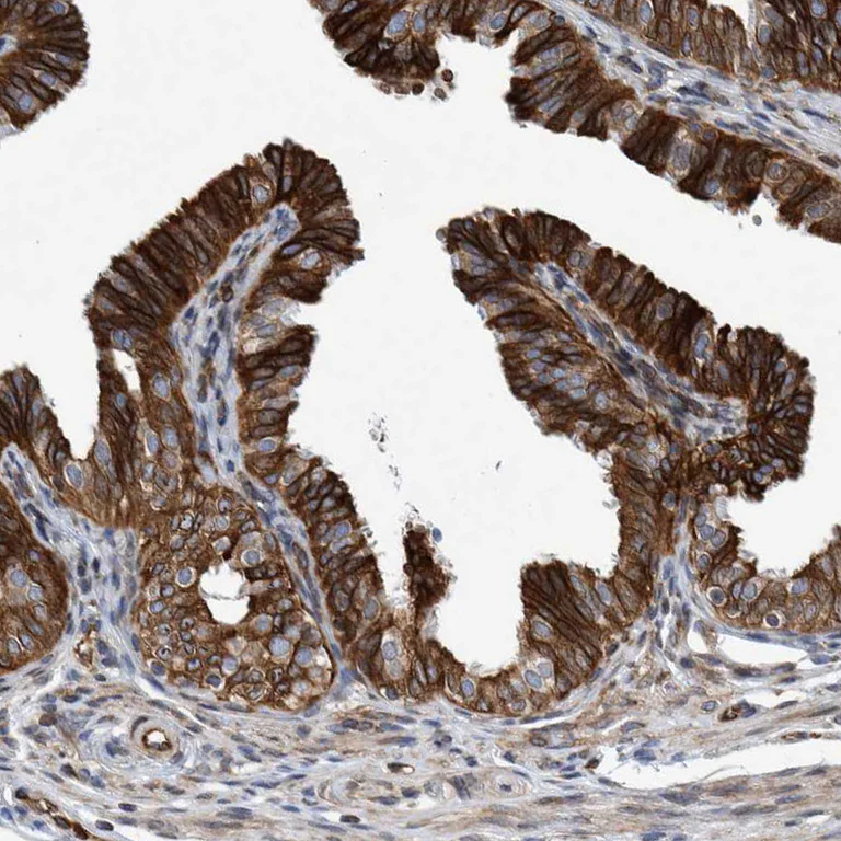 Immunohistochemistry (Formalin/PFA-fixed paraffin-embedded sections) - Anti-C8orf55 antibody (AB121743)