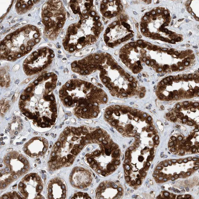 Immunohistochemistry (Formalin/PFA-fixed paraffin-embedded sections) - Anti-C8orf55 antibody (AB121743)