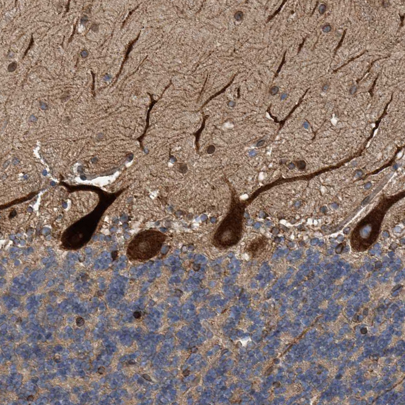 Immunohistochemistry (Formalin/PFA-fixed paraffin-embedded sections) - Anti-C8orf55 antibody (ab121743), expandable thumbnail