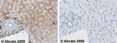 Immunohistochemistry (Formalin/PFA-fixed paraffin-embedded sections) - Anti-C9 antibody [53] (AB17931), expandable thumbnail