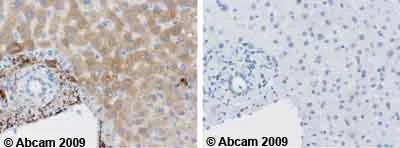 Immunohistochemistry (Formalin/PFA-fixed paraffin-embedded sections) - Anti-C9 antibody [53] (AB17931)