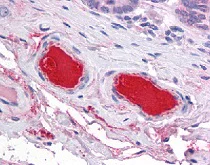 Immunohistochemistry (Formalin/PFA-fixed paraffin-embedded sections) - Anti-C9 antibody (AB118902)
