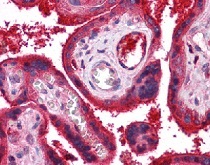 Immunohistochemistry (Formalin/PFA-fixed paraffin-embedded sections) - Anti-C9 antibody (AB118902)