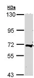 Western blot - Anti-C9 antibody (AB118902)