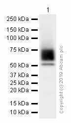 Western blot - Anti-C9 antibody [EPR11232-82] (AB173302), expandable thumbnail