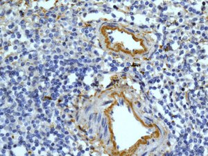 Immunohistochemistry (Formalin/PFA-fixed paraffin-embedded sections) - Anti-C9 antibody [EPR11232-82] - BSA and Azide free (AB240175), expandable thumbnail