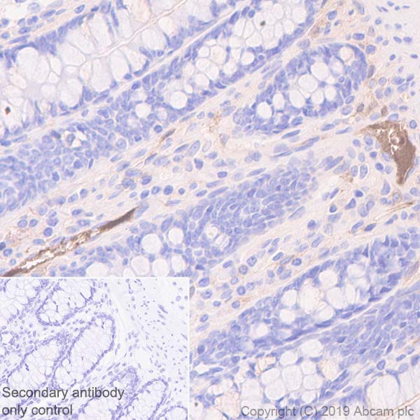 Immunohistochemistry (Formalin/PFA-fixed paraffin-embedded sections) - Anti-C9 antibody [EPR11232-82] - BSA and Azide free (AB240175), expandable thumbnail