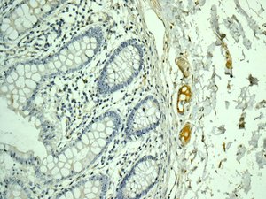 Immunohistochemistry (Formalin/PFA-fixed paraffin-embedded sections) - Anti-C9 antibody [EPR11232-82] - BSA and Azide free (AB240175), expandable thumbnail
