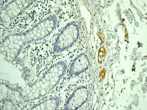 Immunohistochemistry (Formalin/PFA-fixed paraffin-embedded sections) - Anti-C9 antibody [EPR11232-82] - BSA and Azide free (AB240175)
