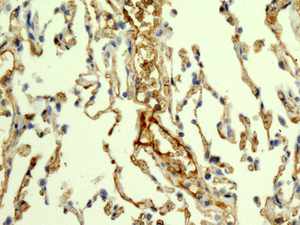 Immunohistochemistry (Formalin/PFA-fixed paraffin-embedded sections) - Anti-C9 antibody [EPR11232] (AB168345)