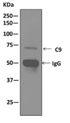 Immunoprecipitation - Anti-C9 antibody [EPR11232] - BSA and Azide free (AB249445)