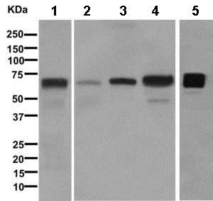 Western blot - Anti-C9 antibody [EPR11232] - BSA and Azide free (AB249445)