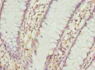 Immunohistochemistry (Formalin/PFA-fixed paraffin-embedded sections) - Anti-C9ORF46/PLGRKT antibody (AB237525)