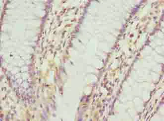 Immunohistochemistry (Formalin/PFA-fixed paraffin-embedded sections) - Anti-C9ORF46/PLGRKT antibody (AB237525)