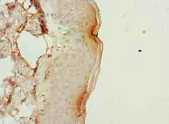 Immunohistochemistry (Formalin/PFA-fixed paraffin-embedded sections) - Anti-C9ORF46/PLGRKT antibody (AB237525)
