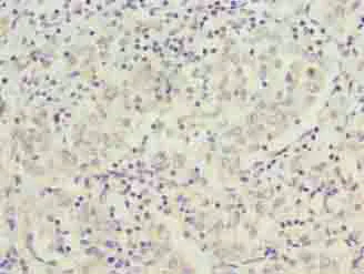 Immunohistochemistry (Formalin/PFA-fixed paraffin-embedded sections) - Anti-C9orf64 antibody (AB236115)