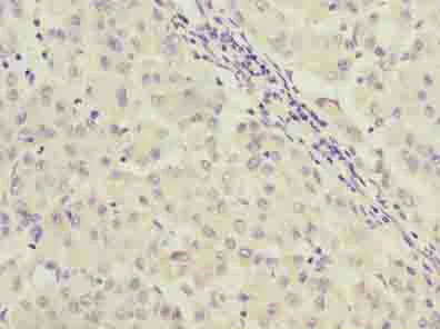 Immunohistochemistry (Formalin/PFA-fixed paraffin-embedded sections) - Anti-C9orf64 antibody (AB236115)