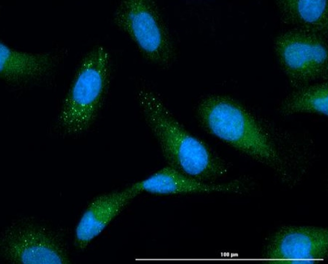 Immunocytochemistry/ Immunofluorescence - Anti-C9orf72 antibody (AB235189)