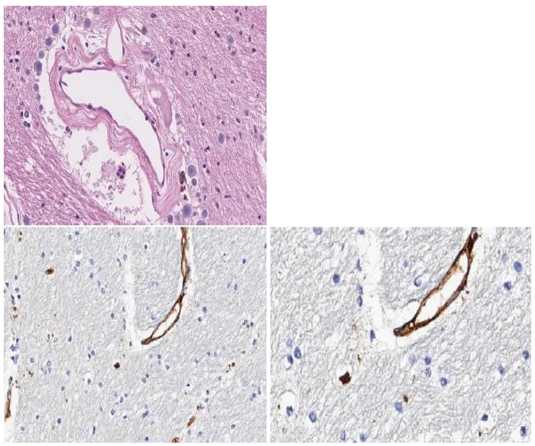 Immunohistochemistry (Formalin/PFA-fixed paraffin-embedded sections) - Anti-C9orf72 antibody (AB235189)