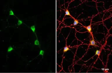 Immunocytochemistry/ Immunofluorescence - Anti-C9orf72 antibody [GT779-RB] (AB308169)
