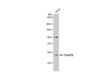 Western blot - Anti-C9orf72 antibody [GT779-RB] (AB308169)