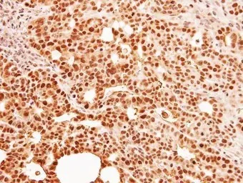 Immunohistochemistry (Formalin/PFA-fixed paraffin-embedded sections) - Anti-C9orf78 antibody (AB97644)