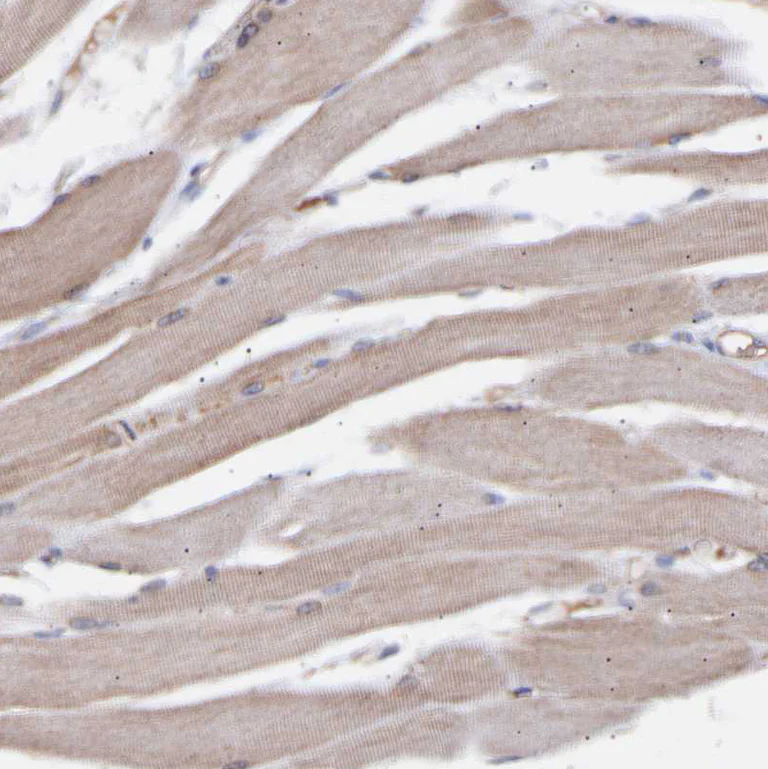 Immunohistochemistry (Formalin/PFA-fixed paraffin-embedded sections) - Anti-C9ORF91 antibody (AB121527)