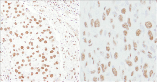 Immunohistochemistry (Formalin/PFA-fixed paraffin-embedded sections) - Anti-CA150 antibody (AB10481)