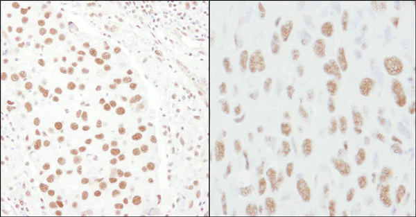 Immunohistochemistry (Formalin/PFA-fixed paraffin-embedded sections) - Anti-CA150 antibody (AB10481)